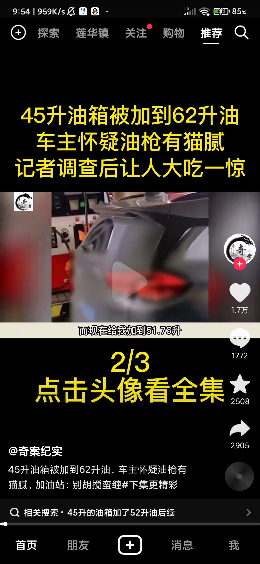 抖音頭像上快進按鈕怎么設置？