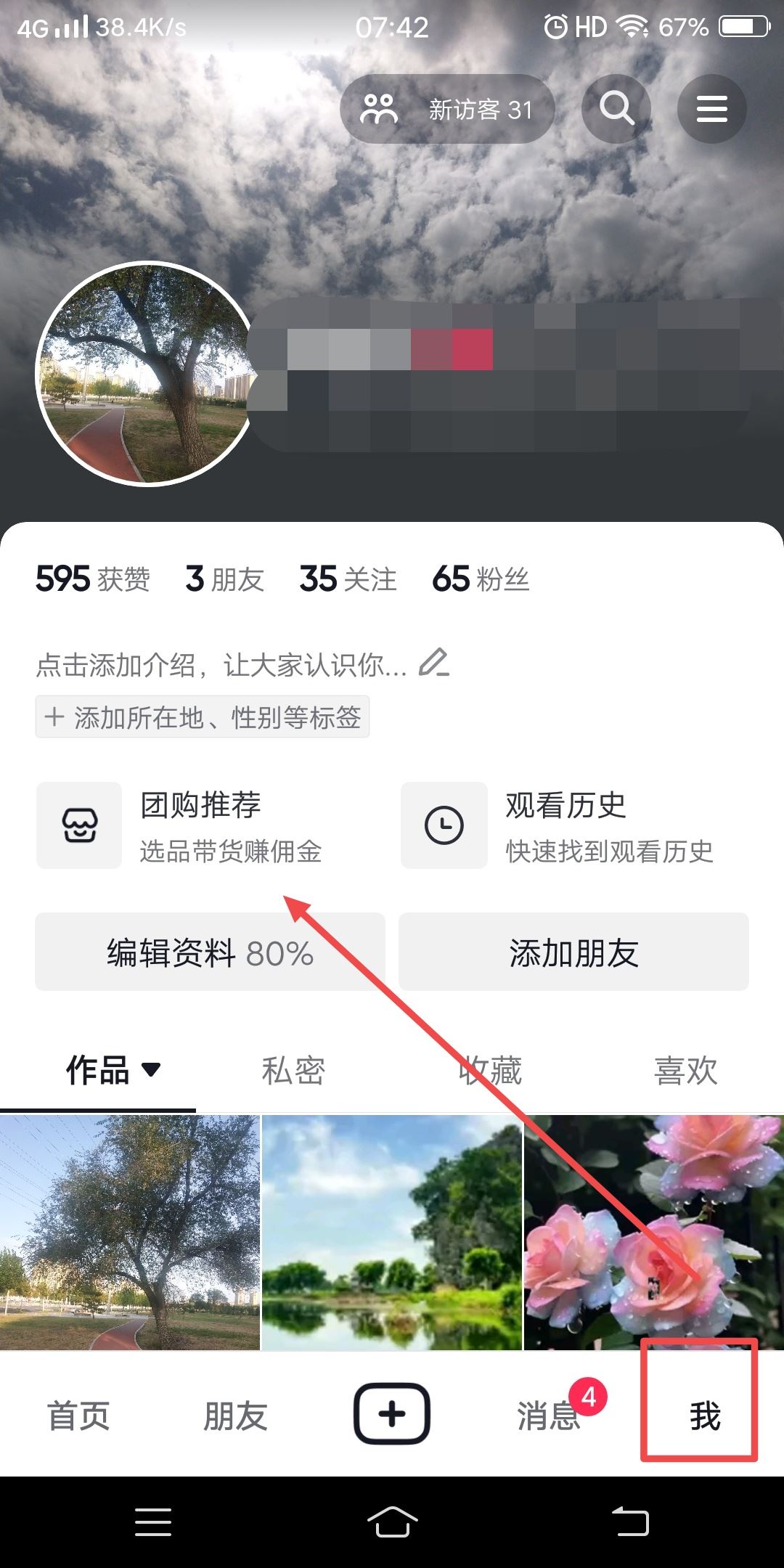 怎么轉發(fā)抖音團購鏈接？