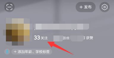 頭條如何添加抖音好友？